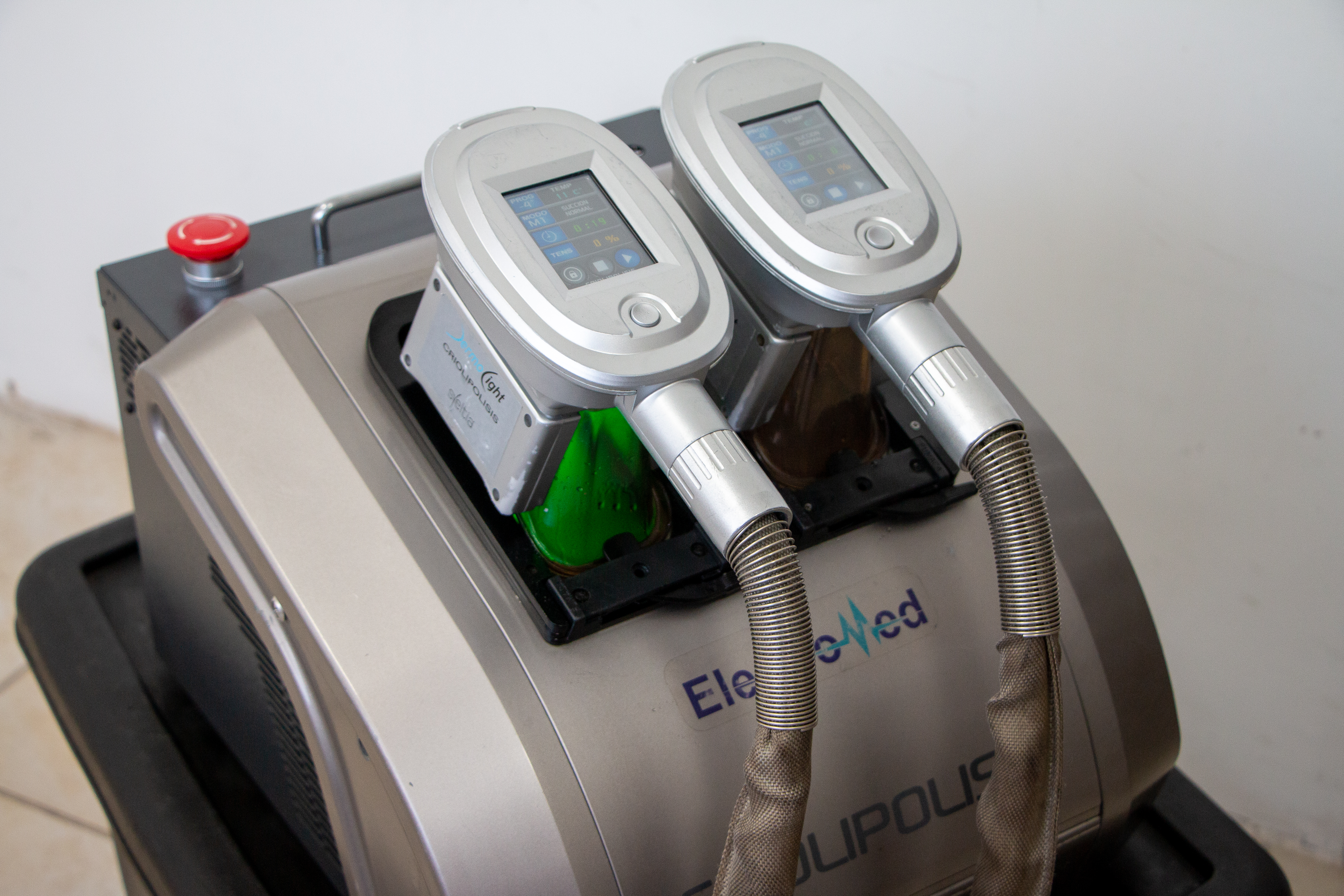 modal criolipólisis imagen